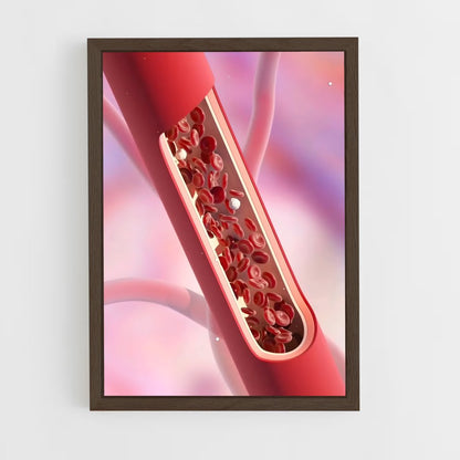ap-artery-1 cadre Bois foncé
