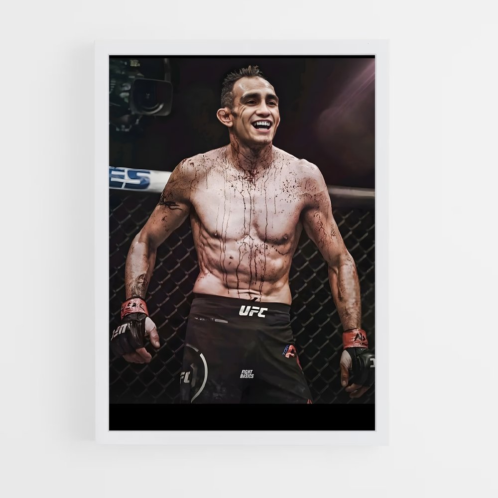 ap-tony ferguson-1 cadre Blanc