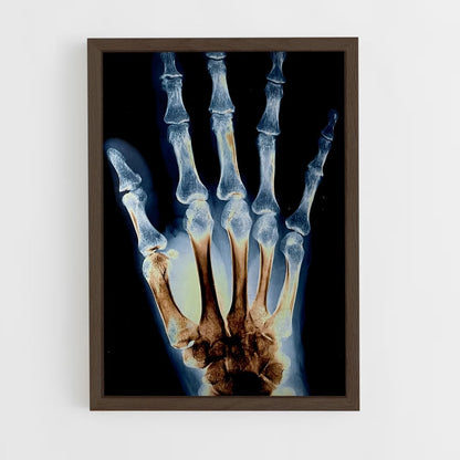 ap-x-rays-2 cadre Bois foncé